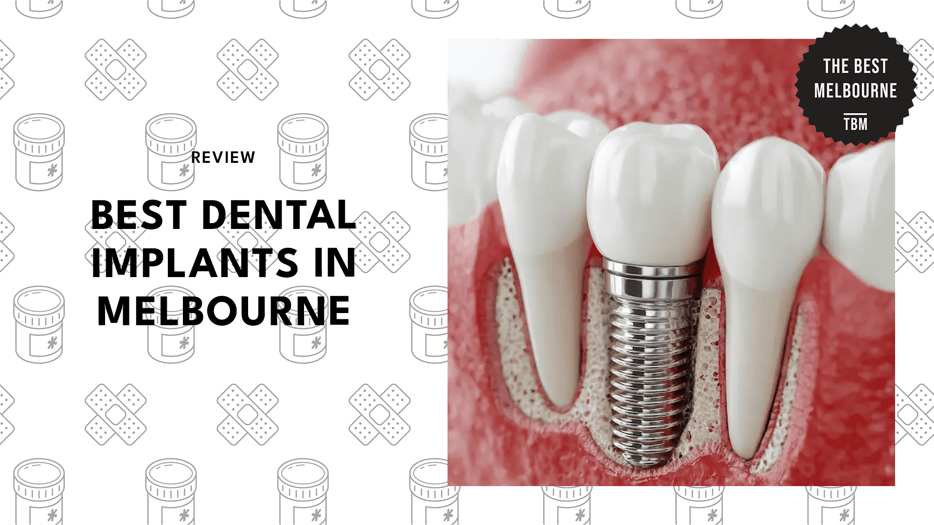 dental-implant-clinics-in-melbourne